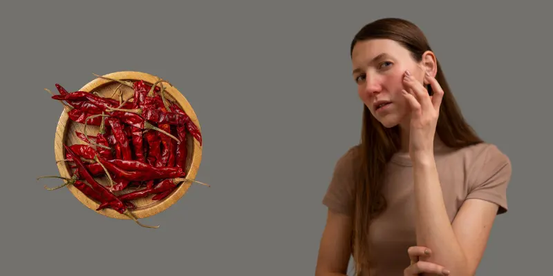 A Young White Girl Is Toucing Her Face Which Is Acne Inflammed And A Plate Of Chillies Are Placed A young white girl is toucing her face-which is acne inflammed and-a-plate of chillies are placed.