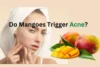 Can Eating Mangoes Cause Acne? - Post Thumbnail