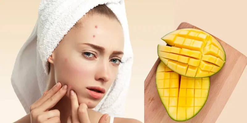 Cut Mangoes Are Placed With A Young White Girl Having Acne On Her Face Cut mangoes are placed with a young white girl having acne on her face