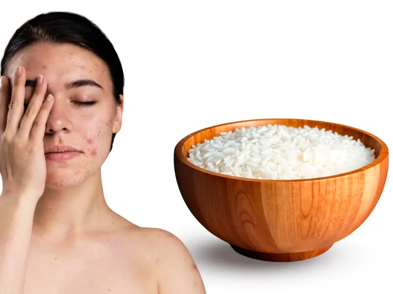 Young White Girl With Acne Hiding Her One Side Of Face With Her Hand In Style And A Bowl Of Uncooked White Rice Are Placed Nearby Young white girl with acne hiding her one side of face with her hand in style and a bowl of uncooked white rice are placed nearby