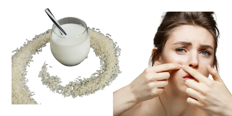 White Young Girl Pinching Acne On Her Face With Hands And A Rice Water And Rice Are Placed Sideby White young girl pinching acne on her face with hands and a rice water and rice are placed sideby